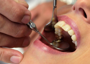 DUS 2. Dönem yerleştirme sonuçları açıklandı